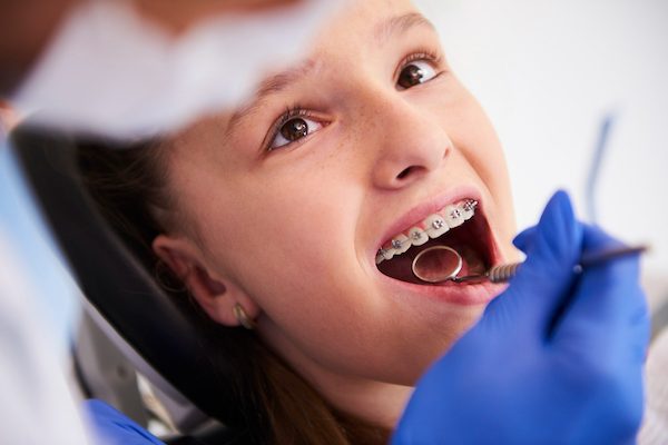 how braces can improve airway health seven hills