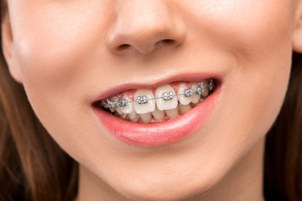 what is involved with orthodontic treatment seven hills