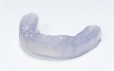 Sports Mouthguard: What Is It and How Does It Help?