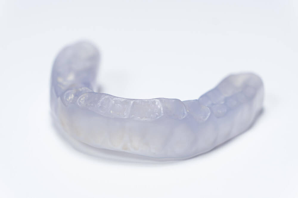 sports mouthguard what is it and how does it help