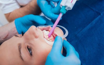 Are Dental Fillings Painful? What to Expect in the Chair
